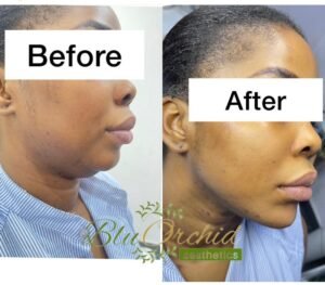 WhatsApp Image 2026-03-15 at 9.02.21 PM