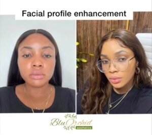 WhatsApp Image 2026-03-15 at 9.23.52 PM