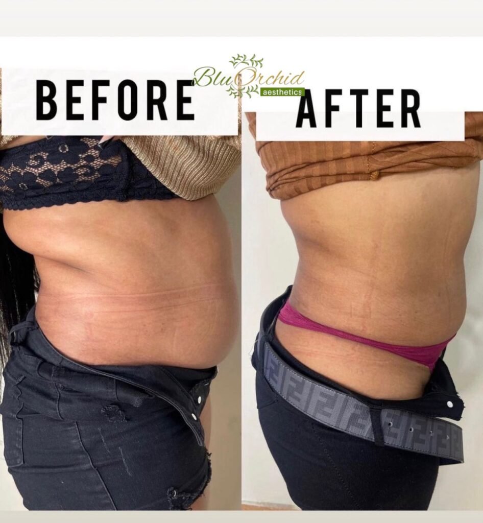 Medical weight management result, Lekki Phase 1