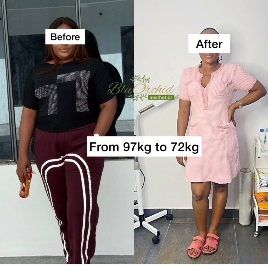 Medical weight loss result at BluOrchid Aesthetics, Lagos