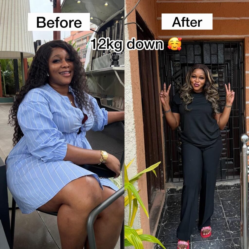 Weight loss before and after at BluOrchid Aesthetics, Lagos